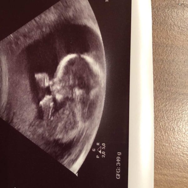 Ultraschallbild 22. SSW - fünfte Schwangerschaft #Baby #Schwangerschaft #Ultraschall #22SSW #SSW22